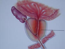 infezioni prostatite blog